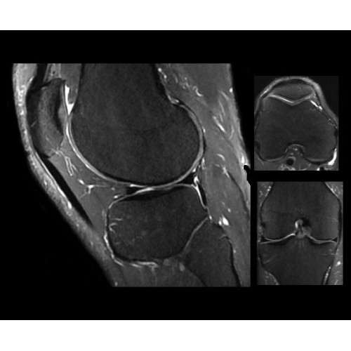 МРТ аппарат GE SIGNA Architect 3.0T