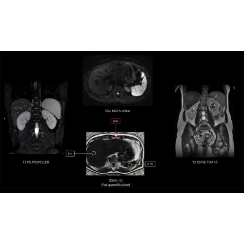 МРТ аппарат GE SIGNA Voyager 1.5T